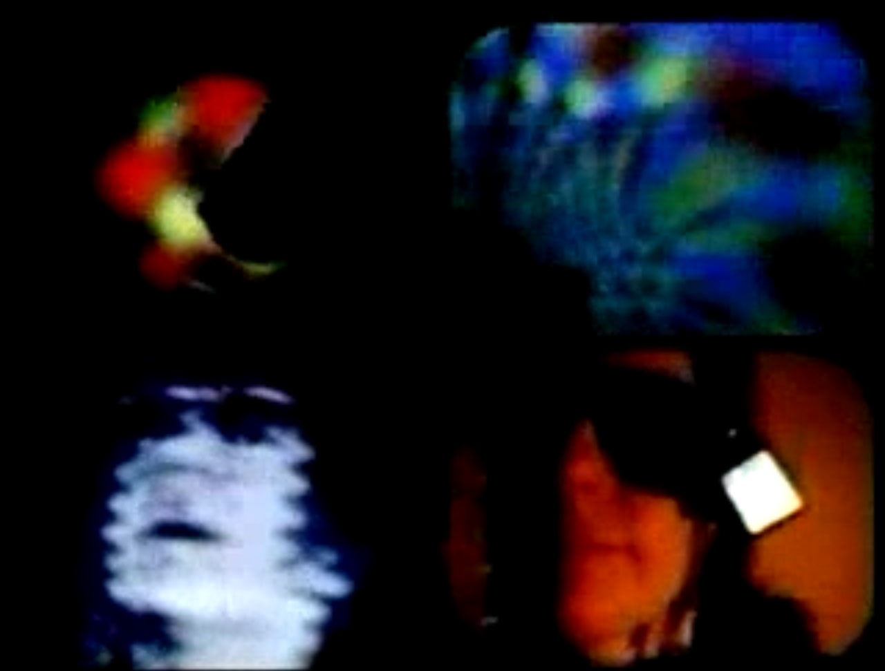Paik: Video Commune - The Beatles From Beginning to End 1970